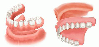 Periodoncia - clínica dental larratxo - larratxo hotz klinika